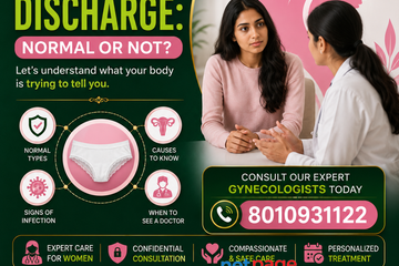 How to Stop White Discharge in Female Naturally – Get Expert Guidance