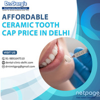 Resonable Ceramic Tooth Cap Price in Delhi