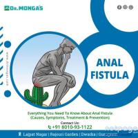 Best Anal Fistula Treatment in Vasant Vihar - 8010931122