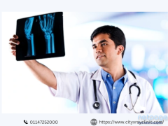 Know the Latest X Ray Price Near You Quick Cost Guide